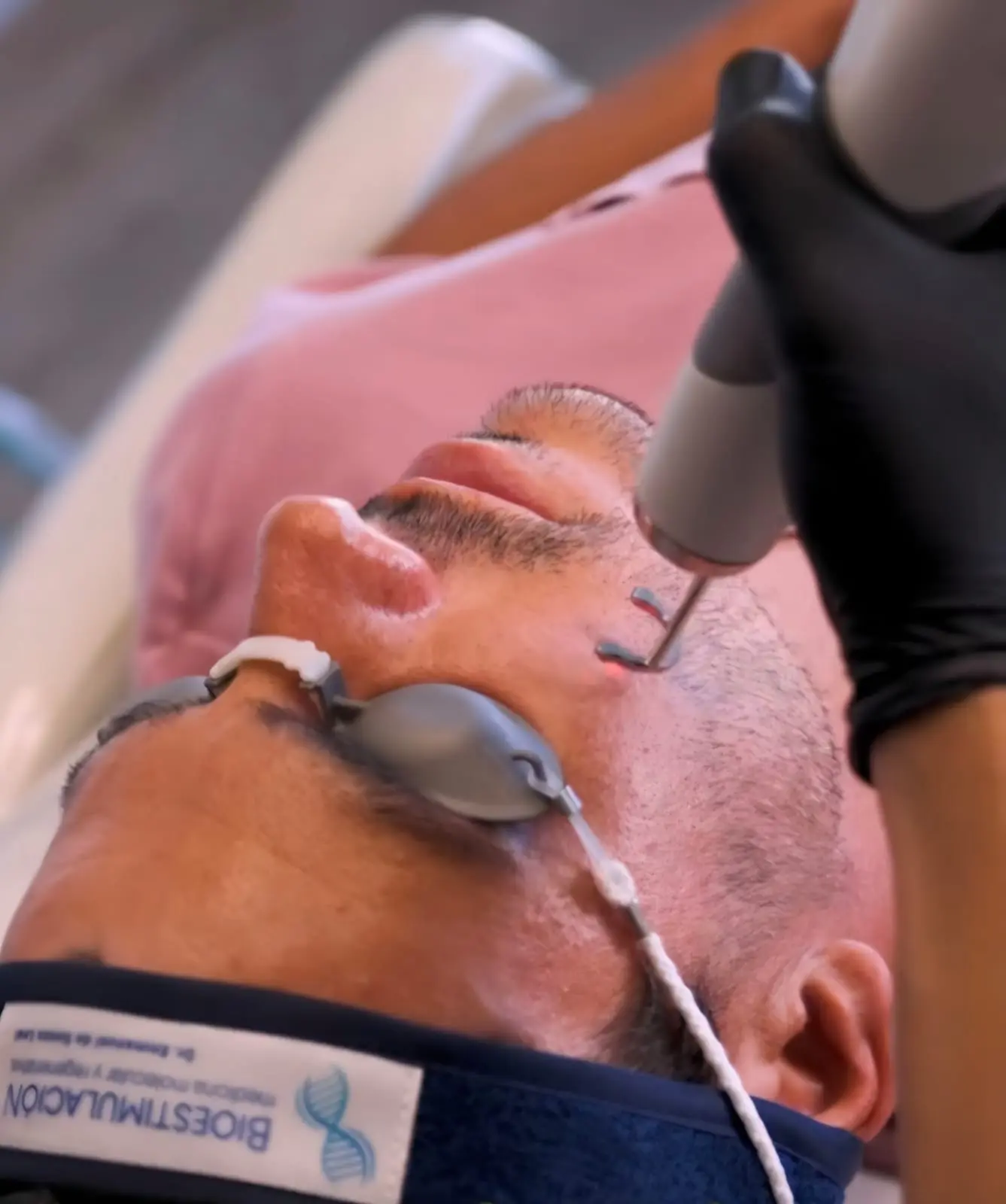 Otros tratamientos estéticos en Montevideo – Bioestimulación
